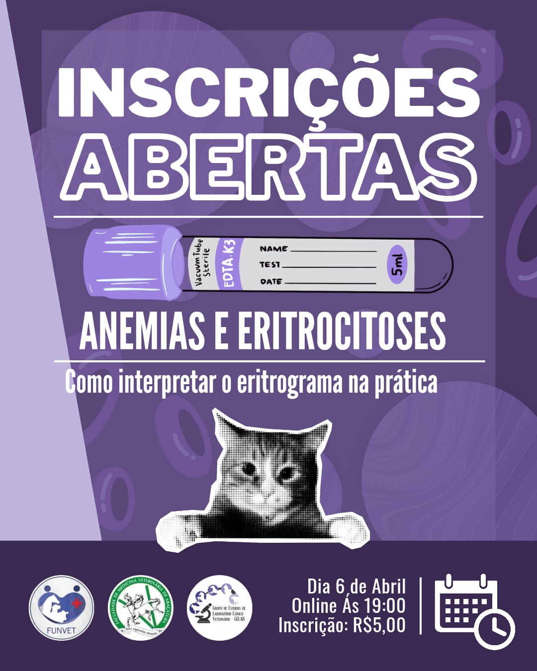Anemia e Eritrocitose: Como Interpretar o Eritrograma na Prática